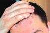 What Your Hair & Scalp Can Say About Your Health